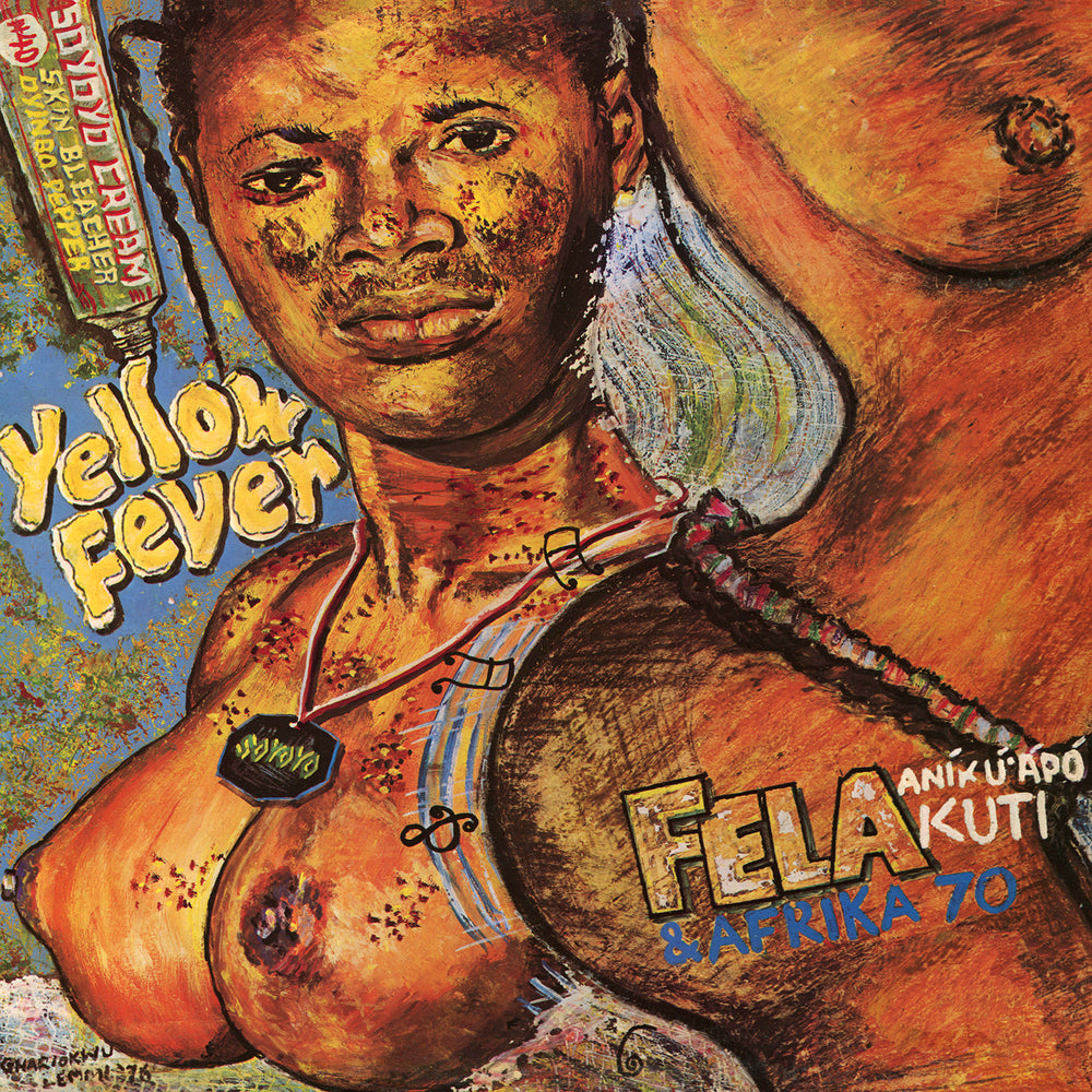 Yellow Fever — Digital Download